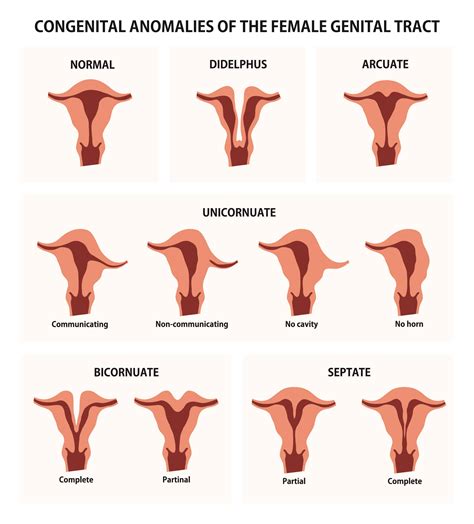 Bells Palsey M request works in postman but not axios Prolapsed uterus (womb): This involves a weakening of a group of ligaments called the uterosacral ligaments at the top of the <b>vagina</b>. . Different shaped pussy
